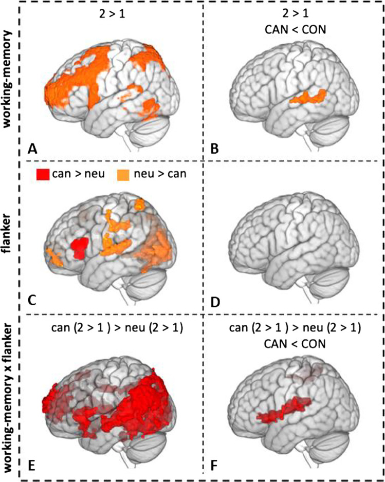 fMRI results. A 2 > 1 working memory–related brain activity across groups; B group difference (cannabis group < control group) in 2 > 1 working memory–related brain activity; C flanker-related activation (cannabis > neutral) and deactivation (neutral > cannabis); D no group differences in flanker-related activation; E activity for the interaction between working memory load and flanker type; F group differences (cannabis group < control group) in activity for the interaction between working memory load and flanker.