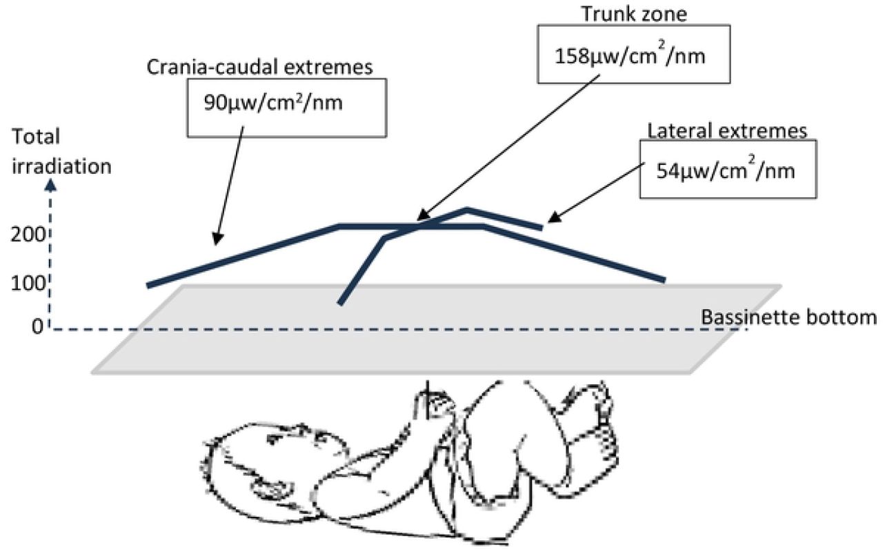 Irradiation distribution across the body segments of a neonate
