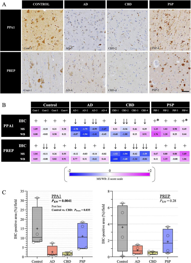 Panel A displays representative immunohistochemistry images of PPA1 and PREP expression in brain tissue from control, AD, CBD, and PSP groups, showing reduced staining in AD and CBD compared to control and PSP. Panel B presents a summary table with IHC qualitative scores and Z-score values for mass spectrometry and Western blot analyses of PPA1 and PREP across individual cases within each group, color-coded from blue to pink reflecting Z-score scale. Panel C shows two boxplots quantifying the percentage of IHC-positive area for PPA1 and PREP, with significantly lower PPA1 in AD and CBD compared to control and PSP, and no significant difference for PREP among groups.