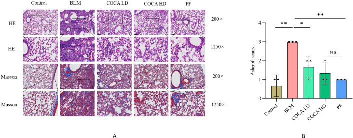 HE staining and Masson staining of lung tissues of mice in each group (200× & 1250×).A. HE staining and Masson staining of lung tissues of mice in each group (200× & 1250×).The Control group had normal alveolar structure with no inflammation on day 7. The BLM group showed severe damage, including disorganized alveoli, thickened septa, and inflammation. The treatment groups had milder changes, with less inflammation and more uniform tissue structure.Masson’s staining showed high collagen levels, structural damage, and fibroblast growth in the BLM group—signs of advanced fibrosis. COCA and pirfenidone reduced collagen buildup and structural damage. The COCA HD group showed the best improvement, with clearer lung structure and less collagen. B. fibrosis scores of rats lung tissues.
