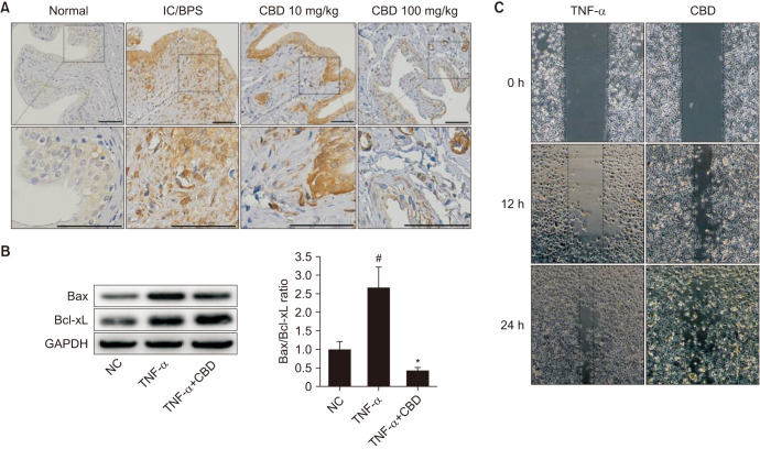 (A) Immunohistochemistry (IH) analysis of caspase-3 expression in different groups: normal control, IC/BPS, and CBD treatment groups (10 mg/kg and 100 mg/kg). Strong caspase-3 expression was observed in the IC/BPS group, while the 100 mg/kg CBD treatment group showed a significant reduction in expression (scale bar=100 µm ). (B) Western blot analysis of Bax and Bcl-xL expression in SV-HUC-1 cells across the control, TNF-α, and TNF-α+CBD treatment groups, with GAPDH used as a loading control to confirm equal protein loading. Quantitative analysis of the Bax/Bcl-xL ratio is shown as a bar graph. Cells were treated with TNF-α alone or in combination with CBD for 24 hours. (C) Scratch assay on SV-HUC-1 cells with TNFα and CBD treatment groups. Images were taken at 0, 12, and 24 hours to assess cell migration and wound closure. Data are expressed as mean±standard deviation. IC/BPS: interstitial cystitis/bladder pain syndrome, CBD: cannabidiol, TNF-α: tumor necrosis factor-alpha, NC: normal control. *p<0.05 compared with the TNF-α group; #p<0.01 compared with the control group.