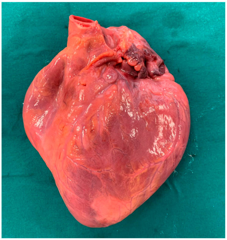 Heart before fixation.