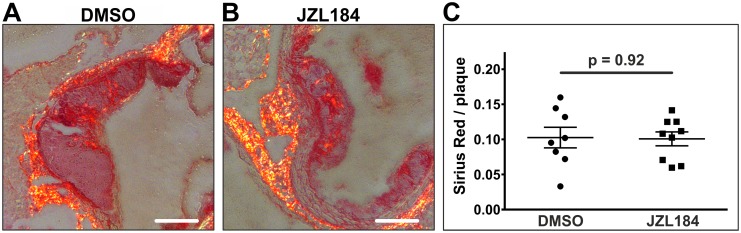 Staining of collagen fibers.Collagen fibers were visualized in the aortic sinus by Picro Sirius staining. Significant amounts of collagen fibers were detected in 8 DMSO-treated animals and in 9 JZL184-treated animals (A, B). Quantity and distribution pattern of collagen fibers did not differ between the two groups (C). Data are presented as mean ± standard error of the mean; n = 8–9; p-value as indicated, assessed by student’s t-test. Scale bar, 200 μm. DMSO, dimethyl sulfoxide; JZL184, inhibitor of monoacylglycerol lipase.
