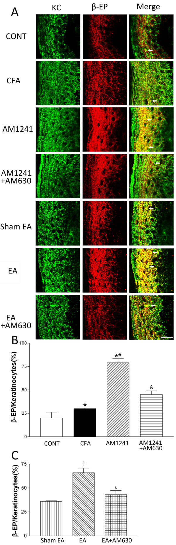 Effects of AM1241, EA, AM1241 plus AM630, and EA plus AM630 on keratinocytes immunorecative to β-endorphin in the skin tissues. A, representative confocal images showing pan cytokeratin positive-keratinocytes (KC, green, left panels) and β-endorphin-immunoreactive cells (β-EP, red, middle panels). The right panels are overlay images showing double-labeled β-endorphin and keratinocytes (Merge, yellow, white arrows). Images include vehicle control (CONT), CFA+vehicle of AM1241 (CFA), CFA+AM1241 (AM1241), CFA+AM1241+AM630 (AM1241+AM630), CFA+sham EA+vehicle of AM630 (sham EA), CFA+EA+vehicle of AM630 (EA), and CFA+EA+AM630 (EA+AM630) groups (Scale bar, 50 μm). B-C, summary graphs show the percentage of keratinocytes labeled with β-endorphin (β-EP) in the total of pan cytokeratin-positive cells in the skin tissues. Data are expressed as means ± SEM (n = 6 rats in each group). * P < 0.05, compared with the vehicle control group; # P < 0.05, compared with the CFA+vehicle of AM1241 group; & P < 0.05, compared with the CFA+AM1241 group; †P < 0.05, compared with the CFA+sham EA+vehicle of AM630 group; $ P < 0.05, compared with the CFA+EA+vehicle of AM630 group (One-way ANOVA followed by Tukey's test).