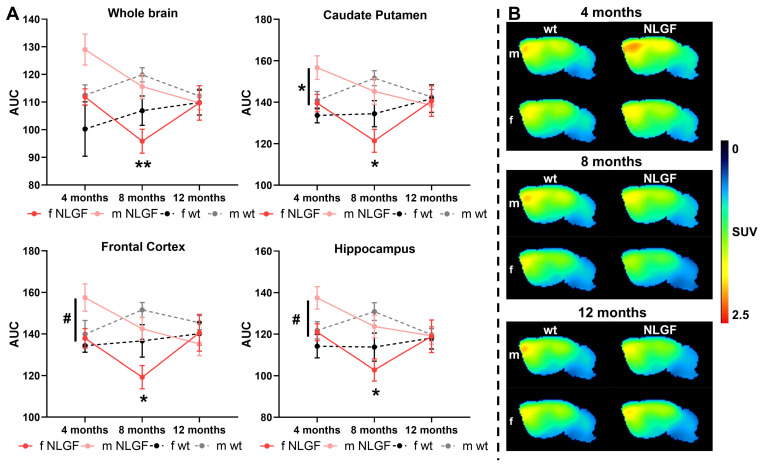 A) AUCs of [18F]MAGL-2102 TACs for AppNL-G-F and wt mice (m/f) at 4-, 8- and 12-months, for whole brain, caudate putamen, frontal cortex and hippocampus. Mean±SEM, #P < 0.10, *P < 0.05 for AppNL-G-F sex comparisons. B) Average summed (0-120 min) images of [18F]MAGL-2102 in brain of wt and AppNL-G-F mice of both sexes (m/f) at 4-, 8- and 12-months of age. Shown are sagittal images at the right side of brain (2 mm from middle line). Abbreviations: AUC: area under the curve; m/f: male, female; NLGF: AppNL-G-F; SUV: standardized uptake value; TAC: time activity curve; wt: wild-type.