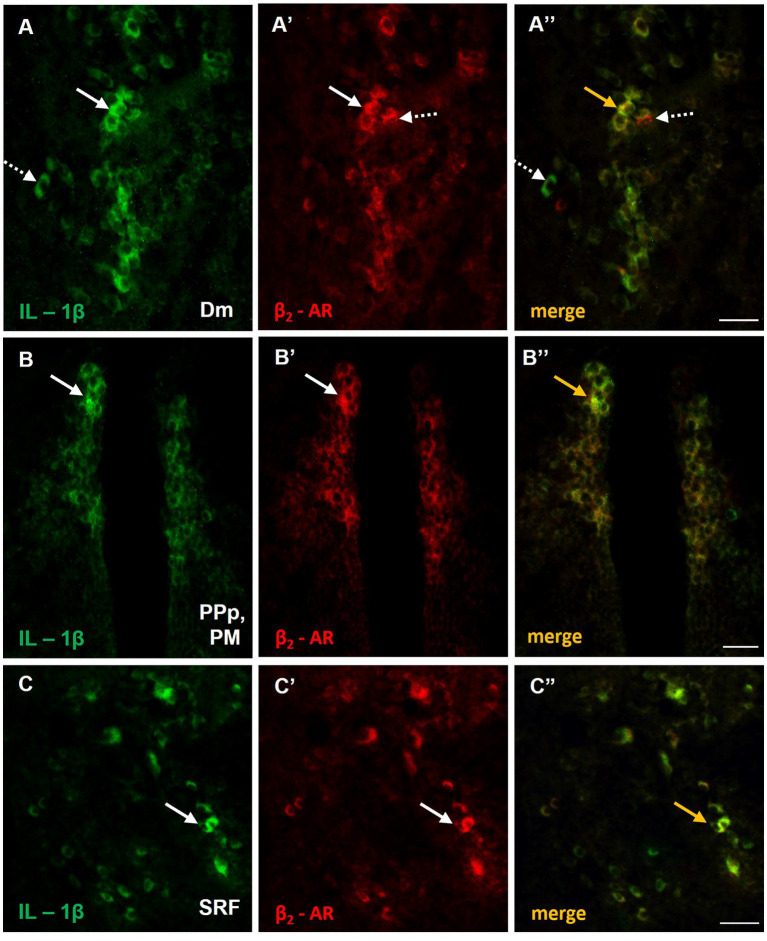 Possible noradrenergic regulation of IL-1β expression through β2-adrenoceptors (β2-ARs) activation within areas of the SDMN. (A–C’’) Immunofluorescent microphotographs of selected transverse sections showing colocalization of IL-1β with β2-ARs in (A–A’’) medial zone of the dorsal telencephalic area (Dm), (B–B’’) parvocellular preoptic nucleus, posterior part/magnocellular preoptic nucleus (PPp, PM), and (C–C’’) superior reticular formation (SRF). Arrows indicate examples of colocalization, dashed arrows point to single positive cells. Microphotographic images are representative of MK-801-treated fish, n = 5. Scale bar: 25 μm.