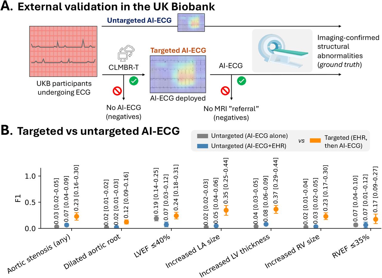 External validation in the UK Biobank.(A) External deployment of the targeted AI-ECG approach in the UK Biobank among 33,518 UK Biobank participants undergoing concurrent ECG and cardiac MRI imaging. We applied the pre-trained encoders and label-specific supervised headers in parallel for both the untargeted and the targeted approach, with SHD defined based by CMR. (B) Summary of F1-score (including 95% confidence intervals derived from bootstrapping with 500 replications) for the targeted vs untargeted AI-ECG screening strategies across eligible SHD labels. AI: artificial intelligence; ECG: electrocardiography; MRI: magnetic resonance imaging; SHD: structural heart disease.