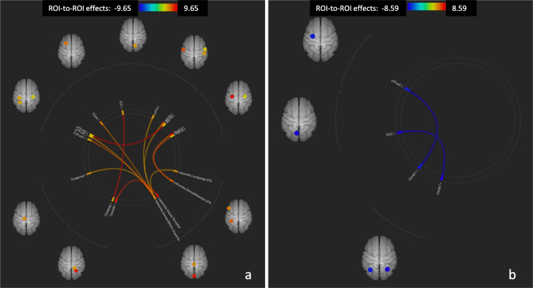 ROI-to-ROI connectome ring maps, Post- vs. Pre- condition, Sativex® non-responders. Increased connectivity (a). Decreased connectivity (b). The colour links are obtained at a ROI-to-ROI connections height threshold (FDR) of P < 0.05, seed ROI height threshold (uncorrected) of P < 0.05, with one-sided positive seed level correction and permutation tests. The colour bar indicates the statistical T value. Cereb45 r (Cerebellum 4 5 Right), Cereb6 r (Cerebellum 6 Right), TOFusC l (Temporal Occipital Fusiform Cortex Left), pTFusC r (Temporal Fusiform Cortex, posterior division Right), pTFusC l (Temporal Fusiform Cortex, posterior division Left), FOrb l (Frontal Orbital Cortex Left), ICC r (Intracalcarine Cortex Right), pITG r (Inferior Temporal Gyrus, posterior division Right), aMTG r (Middle Temporal Gyrus, anterior division Right), aMTG l (Middle Temporal Gyrus, anterior division Left), PreCG r (Precentral Gyrus Right), PreCG l (Precentral Gyrus Left), Cereb1 l (Cerebellum Crus1 Left), Cereb7 r (Cerebellum 7b Right), SCC l (Supracalcarine Cortex Left), aTFusC l (Temporal Fusiform Cortex, anterior division Left)
