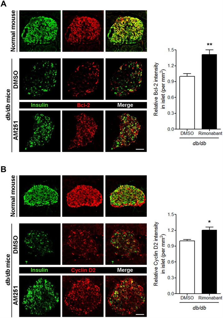 Blockade of CB1Rs in db/db mice increases Bcl-2 and cyclin D2 levels in β cells.(A) Representative images for insulin and Bcl-2 in β cells of normal and DMSO- or rimonabant-injected db/db mice. The relative signal intensity for Bcl-2 in β cells is shown on the right. (B) Representative images for insulin and cyclin D2 in β cells of normal and DMSO- or rimonabant-injected db/db mice. The relative signal intensity for cyclin D2 in β cells is shown on the right. Data are shown as the mean ± SEM from n = 5 animals per group. *P< 0.05; **P< 0.01. Scale bar, 50 μm.