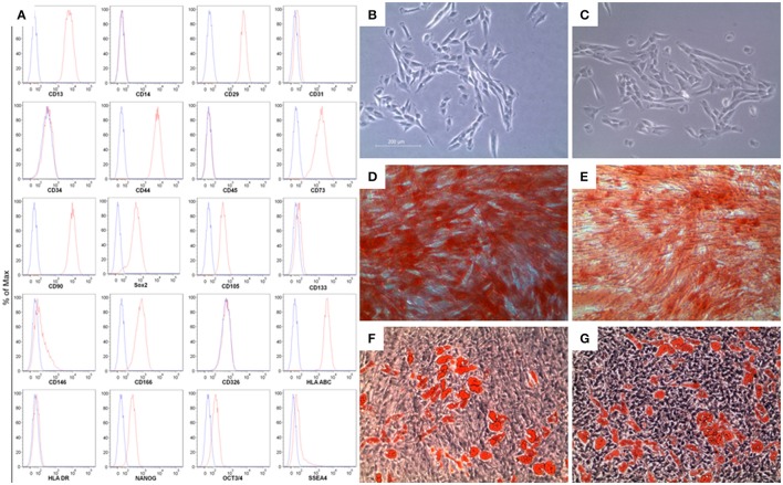 Characterization of gingiva-derived mesenchymal stem cells (hGMSCs). (A) Flow cytometry phenotype of hGMSCs at the second passage during in vitro cultures of surface (CD13, CD14, CD29, CD31, CD34, CD44, CD45, CD73, CD90, CD105, CD117, CD133, CD146, CD166, CD326, HLA-ABC, and HLA-DR) and intracellular (SSEA4, Oct3/4, Sox2, and NANOG) marker expression levels were detected. Red histograms show the distribution of each antigen expression, whereas Blue histograms represent the distribution of the respective background control. (B) The gingival connective tissue-derived mesenchymal stem cells showed colony-forming potency and plastic-adherent characteristics at day 6. (C) CBD-hGMSCs and CTR-hGMSCs showed spindle-shaped, fibroblast-like morphology under light microscope. (D) Osteogenic differentiation at day 21 after Alizarin Red S staining highlighted calcium deposits in CTR-hGMSCs and in (E) CBD-hGMSCs. (F) CTR-hGMSCs and (G) CBD-hGMSCs induced to a dipogenic differentiation after 28 days showed many oil droplets at cytoplasmic level stained with Oil Red O solution. Mag: 10X; bar: 200 μm.