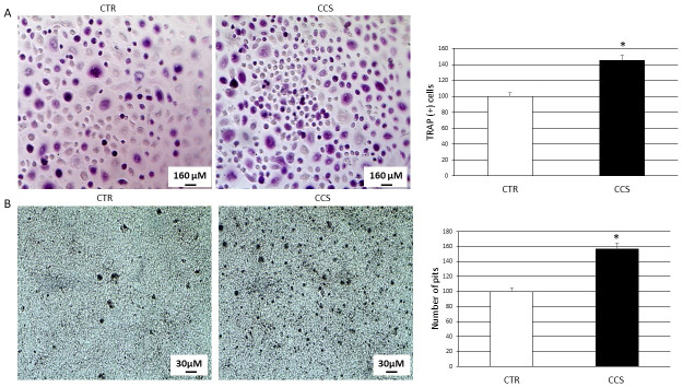(A) TRAP assay on 5 CCS compared with OCs from 5 CTR. The most representative images are displayed (10x magnification). An AE2000 inverted microscope has been used to count TRAP (+) multinucleated (n ≥ 3) OCs (stained purple) in at least three different wells for each individual sample. Histogram shows the percentage number of TRAP (+) cells respect to the total cell number for each sample as mean ± SD. (B) Bone resorption assay on 5 CCS compared with OCs from 5 CTR. The most representative images are displayed (10x magnification). An AE2000 inverted microscope has been used to count the pits (represented in the image as darker areas) on the plate in at least three different wells for each individual sample. Histogram shows the percentage number of pits as mean ± SD. For statistical analysis it has been used a t-test. *Indicates p ≤ 0.05 compared to CTR.
