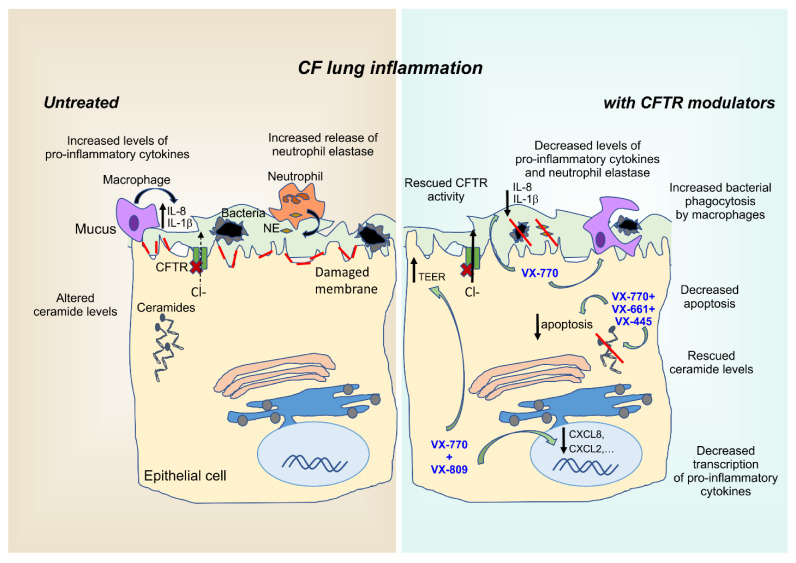 Anti-inflammatory properties of CFTR modulators. CF airways are a highly inflammatory environment characterized by infiltration of inflammatory cells, primarily neutrophils, that fail to effectively clear pathogens entrapped in the abnormally thick and sticky mucus layer. Consequently, failed resolution of this indiscriminate and sterile immune response, further fueled by the abnormal intracellular ceramide levels of airway epithelial cells, disrupts the physiological lung barrier, resulting in reduced TEER values. Besides restoring CFTR activity, CFTR modulators exert various anti-inflammatory effects by targeting intracellular processes, such as ceramide accumulation, cytokine transcription, membrane integrity, and macrophage-mediated phagocytosis of bacteria. Red lines represent the damaged plasma membrane. TEER: transepithelial electrical resistance; NE: neutrophil elastase; VX-770: ivacaftor; VX-809: lumacaftor; VX-661: tezacaftor; VX-445: elexacaftor.