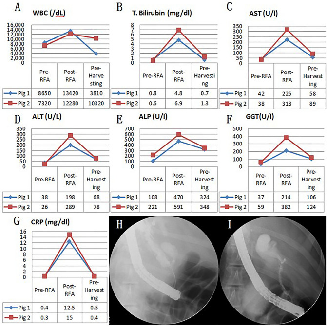 Blood test and cholangiography of biliary stricture pre-RFA, post-RFA, and at 1-month follow-up. (A) WBC changes; (B) T. bilirubin changes; (C) AST changes; (D) ALT changes; (E) ALP changes; (F) GGT changes; (G) CRP changes of 1 month follow-up pigs; (H) Cholangiography of biliary stricture at 1-month follow-up (pig 1); (I) Cholangiography of biliary stricture at 1-month follow-up (pig 2). WBC white blood cell count, T. bilirubin total bilirubin, AST aspartate transaminase, ALT alanine transaminase, ALP alkaline phosphatase, GGT gamma-glutamyl transferase, CRP C-reactive protein.