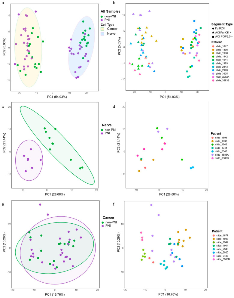 Expression measured in 74 regions collected by DSP GeoMx. (a) Principal component analysis (PCA) of normalized expression of regions profiled in cancer and nerve compartments that pass QC (n = 74). Gene counts showed separations of cancer and nerve regions. Each dot represents expression of region profiled and is colored by location in PNI or non-PNI foci. Circles indicate 95th percentile of expression. (b) PCA, same data presented in (a), colored by patient from whom samples were collected. (c) Normalized expression of full ROIs collected from nerve compartments (n = 17) in PNI or non-PNI foci. PCA separated nerves with PNI from non-PNI (without visual signs of invasion). (d) Same data presented in (c), colored by patient from whom samples were collected. (e) Normalized expression of AOIs (areas segmented by PanCK positivity) collected from cancer compartments (n = 40) in PNI or non-PNI foci. (f) Same data presented in (e), colored by patient from whom samples were collected.