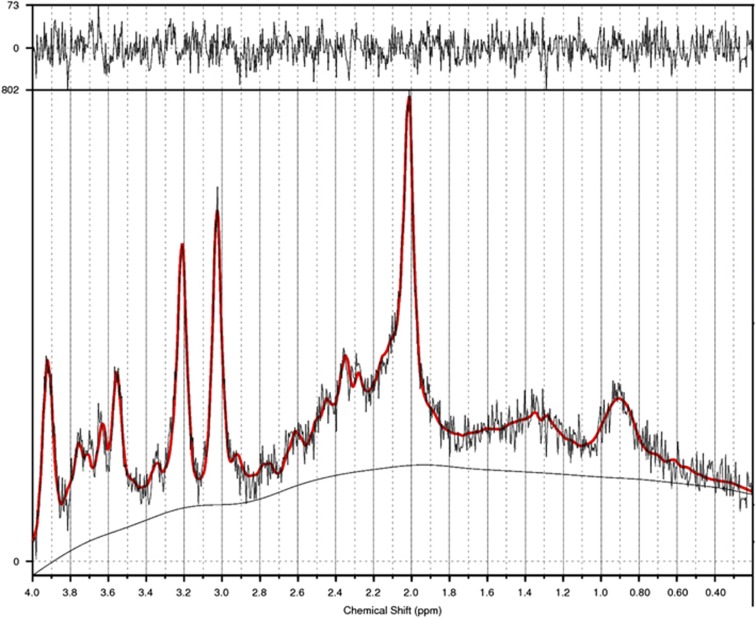 An example of LCModel output for magnetic resonance spectroscopy spectrum from the hippocampus. The red solid line indicates the summary of all fitted metabolites' peaks. For N-acetylaspartate (NAA), the major peak is located at 2.02 p.p.m. Mean NAA across all groups (N=82) was 6.35 (s.d.=0.97). Separately for each group, mean NAA values were as follows: healthy control, 6.40 (s.d.=0.89); CBDx, 6.28 (s.d.=0.90); CBD−, 5.82 (s.d.=1.11); CBD+, 6.54 (s.d.=0.76); and Former Users, 6.94 (s.d.=0.86).
