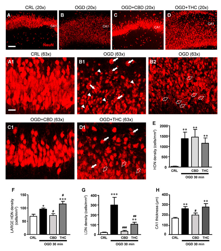 (A–D) Representative confocal images of neurons immunostained using antibodies against NeuN in CA1 of a CRL (A), OGD (B), OGD + CBD (C), and OGD + THC slice (D) captured with a 20x objective, scale bar: 75 µm. (A1–D1) Confocal images obtained stacking 10 consecutive z-scans acquired in the depth of the corresponding slice shown in (A–D), respectively (0.3 µm each, total thickness 3 µm), captured with a 63x objective. A1: Image taken from the control slice in A showing healthy pyramidal neurons in CA1. (B1,B2) Both images of CA1 were taken from the OGD slice in (B) and show clearly that neurons are profoundly damaged after OGD. (B1) HDN neurons (arrowheads), large HDN neurons (white arrows); (B2) LDN neurons (open arrows). (C1) The image of CA1 taken from the OGD + CBD slice in (C) shows that pyramidal neurons have a healthy appearance. (D1) The image taken from the OGD + THC slice in (D) shows large HDN neurons (white arrows) and LDN neurons (open arrows). (A1–D1) scale bar: 20 µm. (E–G) Quantitative analyses of neuronal morphological alterations in CA1. (E) density of HDN neurons. Statistical analysis: one-way ANOVA p < 0.001; ** p < 0.01 vs. CRL, Newman–Keuls post hoc test; (F) density of large HDN neurons. Statistical analysis: One-way ANOVA p < 0.0001; * p < 0.05 and *** p < 0.001 vs. CRL, # p < 0.05 vs. OGD, Newman–Keuls post hoc test. (G) density of LDN neurons. Statistical analysis: One-way ANOVA p < 0.0001; ** p < 0.01 and *** p < 0.001 vs. CRL, ### p < 0.001 vs. OGD, ## p < 0.01 vs. OGD and OGD + CBD, Newman–Keuls post hoc test). (H) Thickness of CA1. Statistical analysis: One-way ANOVA p < 0.01; ** p < 0.01 vs. CRL, # p < 0.05 vs. OGD, Newman–Keuls post hoc test. Bars represent the mean ± SEM of at least 8 experiments.