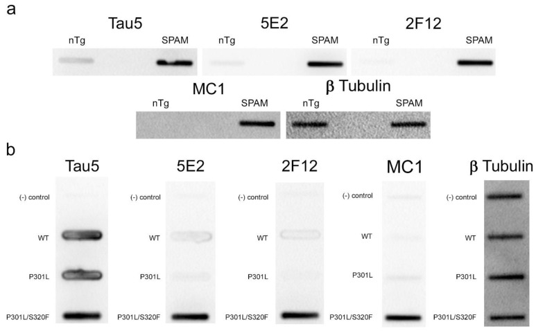 5E2 and 2F12 immunolabelling under non-denaturing conditions. Non-denaturing immunoblotting using a slot blot assay was performed on mouse and HEK293T cell lysates. Antibody labelling was investigated using brain lysate from nTg and SPAM Tg mice (a) and lysates from non-transfected HEK293T cells (−) and HEK293T cells transfected to express WT, P301L or P301L/S320F 0N/4R tau (b). Several antibodies were used as controls: Tau5 as control for mouse and human tau, MC1 as conformation-dependent tau antibody, and anti-β-tubulin as a loading control.