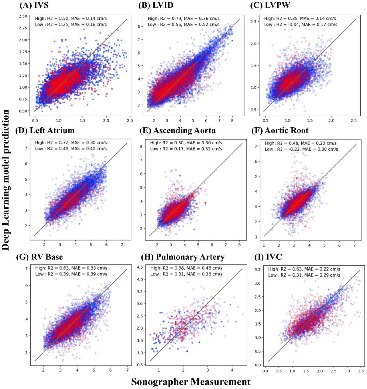 Correlation between Deep Learning Model and Sonographer Annotations for Echocardiographic Linear Measurements of B-mode Classified by Predicted Image-QualityScatterplot between deep learning model predictions and sonographer annotations for various echocardiographic linear measurements, classified by predicted image quality. Each plot represents a specific measurement, with the x-axis showing the values annotated by the sonographer and the y-axis showing the values predicted by the Deep Learning model. Blue dots indicate higher quality images predicted by image-quality model, and red dots indicate lower quality images predicted by the same model. The coefficient of determination (R2) and mean absolute error (MAE). For a detailed explanation of echocardiography parameter abbreviations, refer to Supplemental Table 1.
