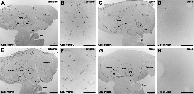 Detection of CB1R and CB2R mRNA using in situ hybridization. Using colorimetric in situ hybridization in a naïve primate, CB1R and CB2R mRNA (panels a, b and e, f, respectively) were detected in the GPi nucleus. The sense probes did not provide specific labeling of CB1R or CB2R mRNA (panels c, d and g, h, respectively). Even at low magnification, a lack of stain when using sense probes for CB1R and CB2R mRNA (panels c and g) was observed in the hippocampal formation, which was stained specifically when using antisense probes for both transcripts (a and e). Scale bar is 3,000 μm for panels a, c, e and g and 150 μm for insets b, d, f and h. ac anterior commissure, GPe external division of the globus pallidus, GPi internal division of the globus pallidus, hipp hippocampal formation, ot optic tract, SN substantia nigra, STN subthalamic nucleus