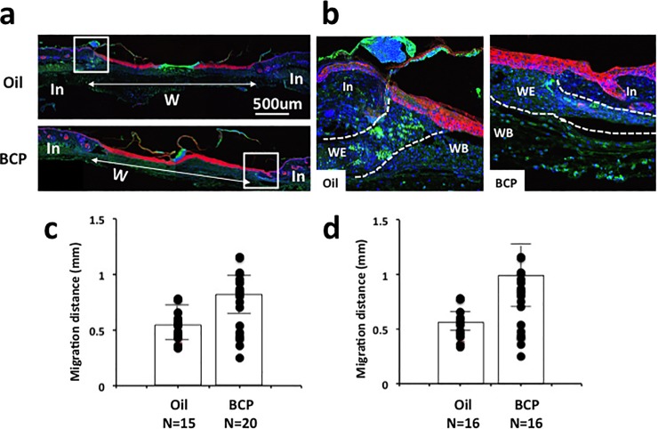 Re-epithelialization measured by keratin 14.(a) Immunofluorescence staining of K14 (red) and PCNA (green) with nuclear staining using Draq5 (blue) of skin with wound treated with BCP or with oil. (b) Higher magnification images of areas of boxes in (a). PCNA was localized in the nucleus and, when density of cells increased, it became localized in the cytoplasm (b). This was observed at the center of the wound. In: intact area, W: wounded area. (c, d) Length of K14+ staining area from the boundary of intact and wounded area to the center of the wound in skin harvested on post-surgery day 3 (c) and 4 (d). Dots indicate each datum and the height of bars indicates the median. Horizontal lines indicate quartiles. 3rd day, Kolmogorov-Smirnov test, P = 0.008, BCP, n = 20, Oil, n = 15; 4th day, Kolmogorov-Smirnov test, P = 0.002, *: P<0.05, BCP, n = 16, Oil, n = 16.