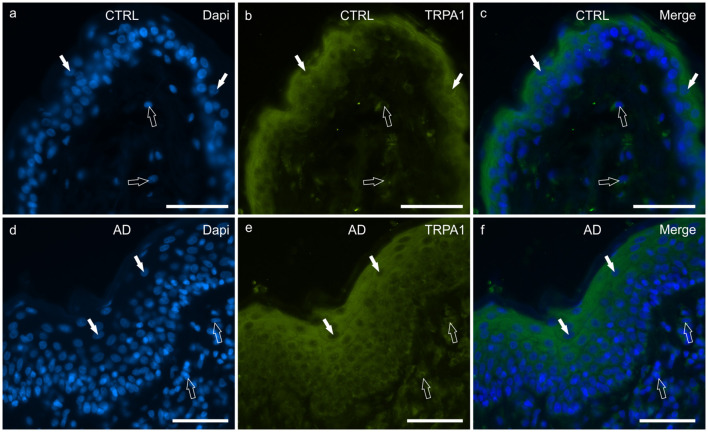 Photomicrographs of cryosections of canine skin showing transient receptor potential ankyrin 1 (TRPA1) immunoreactivity (IR) in the tissues of the healthy dogs (CTRL) (a–c) and in the dogs with atopic dermatitis (AD) (d–f). (a–c) The white arrows indicate some DAPI-labeled nuclei of the keratinocytes of the CTRL dogs showing moderate cytoplasmic TRPV1-IR. The TRPA1 immunolabelling was brighter in the more superficial cells. The open arrows indicate some DAPI-labeled nuclei of the dermal cells showing moderate TRPV1-IR. (d–f) The white arrows indicate some DAPI-labeled nuclei of the keratinocytes of the AD dogs showing bright cytoplasmic TRPV1-IR. Not all the cells of the suprabasal layer showed the same degree of TRPA1-IR which was brighter in the cytoplasm of the more superficial cells. The open arrows indicate some DAPI-labeled nuclei of the dermal cells showing bright TRPA1-IR. Bar, 50 μm.