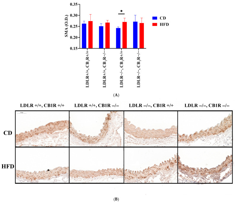 (A). Smooth muscle actin immunostaining of aortas from mice with genotypes LDLR+/+CB1R+/+ (wild-type), LDLR+/+CB1R−/−, LDLR−/−CB1R+/+ and LDLR−/− CB1R−/− kept on a control diet or on a high-fat diet for 5 months. (*, p < 0.05 between groups indicated) (B). Representative photos of SMA-stained aortas are shown. Mean ± SEM values of optical density (O.D.) are shown (A). Abbreviations: SMA: smooth muscle actin, LDLR: low-density lipoprotein receptor, CB1R: cannabinoid type 1 receptor, CD: control diet, HFD: high-fat diet.