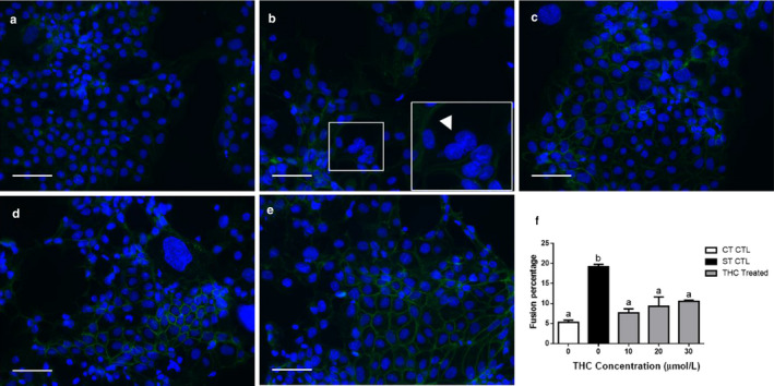 BeWo cell fusion is reduced following exposure to THC. BeWo cells showing immunofluorescent staining (a–d) for E‐cadherin distribution at the cell membrane using FITC‐conjugated secondary antibody (green) and counterstained with DAPI identifying the nuclei (blue). Representative fluorescent microscopy images (magnification 200×) are shown (a–e), selected from five random, nonoverlapping regions per treatment group (n = 3); scale bars indicate 100 µm. a = CT control; b = ST control (EGF, FSK); c = 10 µM THC, EGF, FSK; d = 20 µM THC, EGF, FSK; e = 30 µM THC, EGF, FSK. Insets represent close‐up magnifications of E‐cadherin localization with an example of multinucleated syncytiotrophoblasts (arrowhead in panel b). Cell counts were performed by two researchers and the average was used to determine the fusion percentage across all groups (f). Significant differences were determined by a one‐way ANOVA, followed by a Bonferroni post hoc test. Data are presented as means ± SEM (n = 3). Different letters denote significant differences among control and treated groups at p < .01