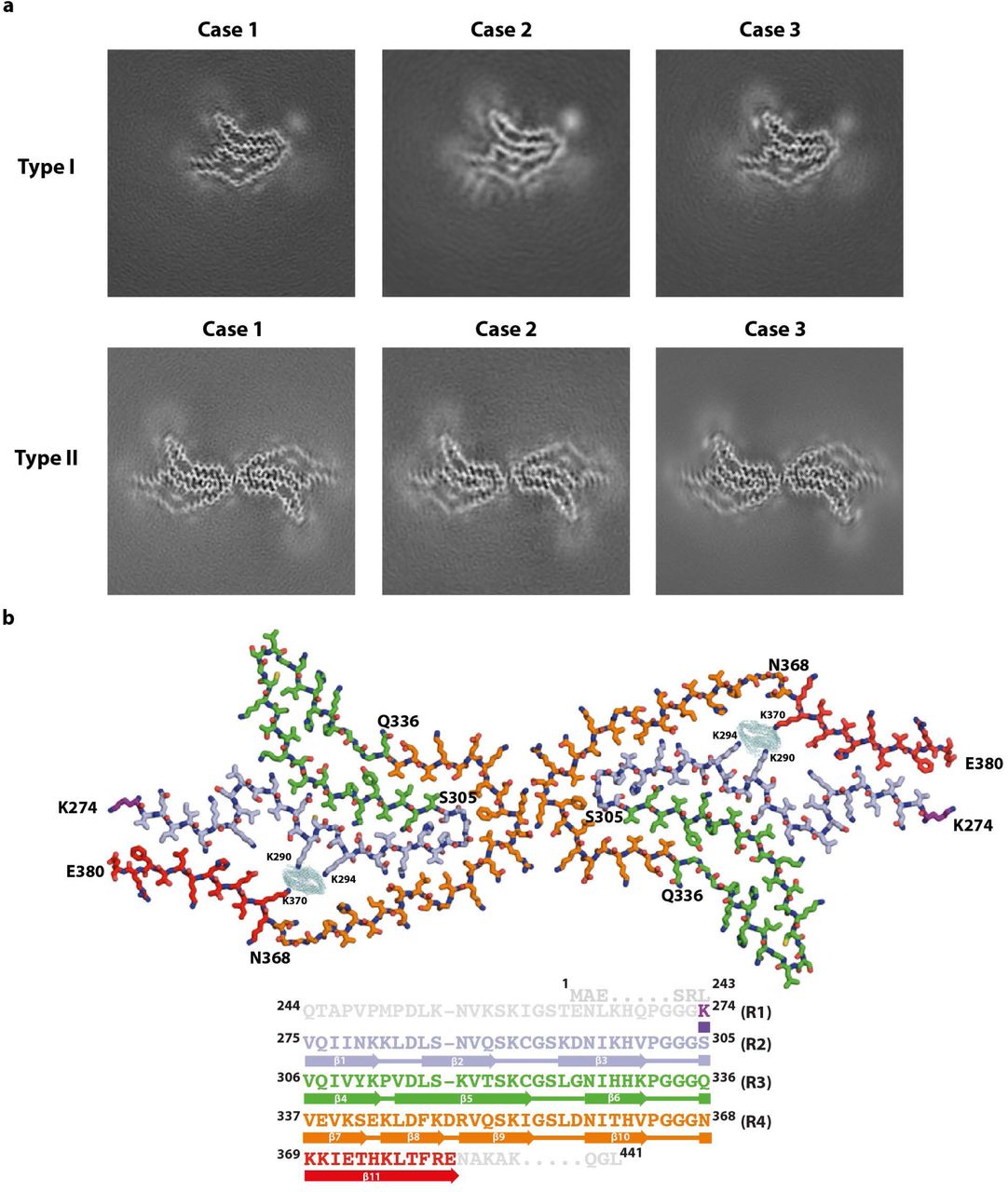 Cryo-EM maps of CBD Type I and Type II tau filaments and atomic model of Type II filaments.(a), Cryo-EM maps of Type I tau filaments (upper panels) and Type II tau filaments (lower panels) from the frontal cortex of cases 1-3. (b), Atomic model of the CBD Type II tau filament (upper panel). The extra density is shown in light blue, with K290, K294 and K370 indicated. Schematic depicting the microtubule-binding repeats (R1-R4) of tau and the sequence after R4 that is present in the core of CBD filaments (all shown in different colours) (lower panel). The positions of β-strands (β1-β11) are indicated.