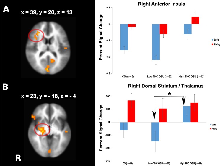 Effects of co-use of marijuana.Occasional stimulant users with relatively high numbers of lifetime co-use of marijuana (High THC OSU) are characterized by (A) a weaker relative deactivation of the right anterior insula to risky and safe decisions (main effect of subgroup,) and (B) a weaker neural differentiation of risky and safe decisions in the dorsal striatum compared to Low THC OSU driven by an absent relative decrease of activation during safe decisions (interaction subgroup by decision), n = 120. Cluster significance of p < .05 corrected for multiple comparisons (voxel-wise probability: p < .05). R indicates right, error bars represent standard errors, asterisk = sign. at p = 0.05.
