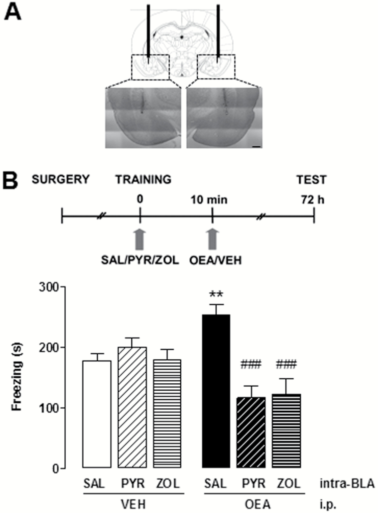 Effect of histamine receptor antagonism on oleoylethanolamide (OEA)-induced freezing enhancement. (A) Schematic diagram and photomicrographs showing the position of the cannulae. The injection needle protruded 1 mm below the tip of the cannulae. (B) Rats received bilateral intra-basolateral amygdala (BLA) infusions of zolantidine (ZOL), pyrilamine (PYR), or vehicle, and OEA or vehicle i.p. immediately after training. Data are expressed as means ± SEM of 9 to 14 animals for each group; ANOVA and Newman-Keuls’ posthoc test, **P < .01 vs SAL/VEH controls; ###P < .001 vs SAL/OEA.