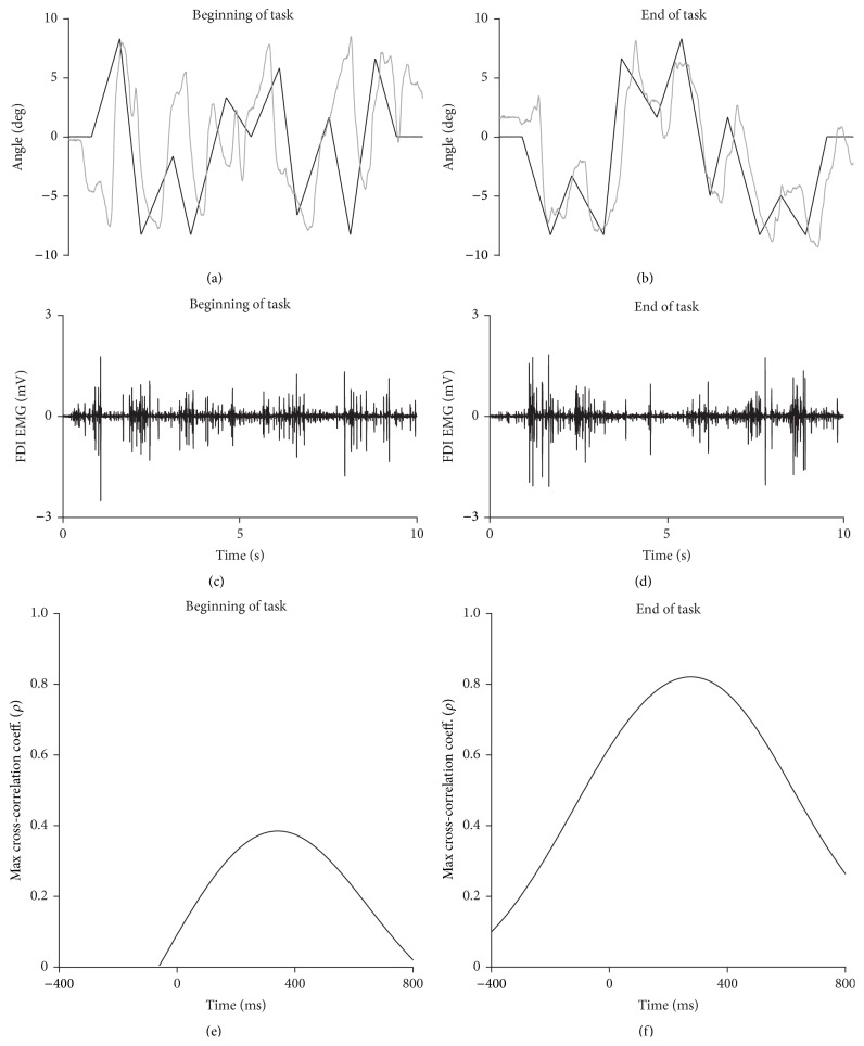 Single-subject data for the three-minute visuomotor tracking task. Data are from an individual in the stimulant group. (a) and (b) Raw metacarpophalangeal joint angle trace (grey line) and target line (black line) at the beginning of the first (0–30 s) and last (150–180 s) epoch, respectively. (c) and (d) Raw EMG traces for the accompanying time frame. (e) and (f) Cross-correlogram for the same subject for the first (0–30 s) and last (150–180 s) epoch, respectively.