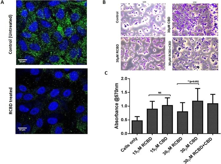 RCBD binds to cell surface integrins and causes decreased adherence of ARPE-19 cells to collagen as compared to CBD: (Panel A) Immunofluorescence staining of β1 integrin in ARPE-19 cells. Cells were seeded on coverslips in presence of vitreous derived from patients undergoing surgery for retinal detachment, in the absence and presence of RCBD; immunofluorescence staining was done using mouse anti-β1 integrin antibody and goat anti-mouse-FITC secondary antibody. β1 integrin-associated fluorescence is shown in green and nuclei (DAPI) in blue; scale bar: 50 µm (Panel B) Adherence of ARPE-19 cells (untreated or pre-treated with CBD and/or RCBD) on collagen coated surface; adhered cells were imaged; scale bar: 400 µm, 10X magnification; and (Panel C) Bar diagrams represent the corresponding quantitative data.