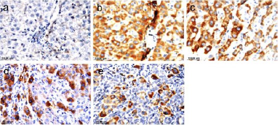 Immunohistochemical detection of p53 (×40 & ×80). Sham group shows a negligible positive reaction (a), bile duct ligated group shows highest reaction (b & c), group treated with silymarin shows decrease in reaction (d), while AM1241 treated group shows a more noticeable decrease in reaction (e)