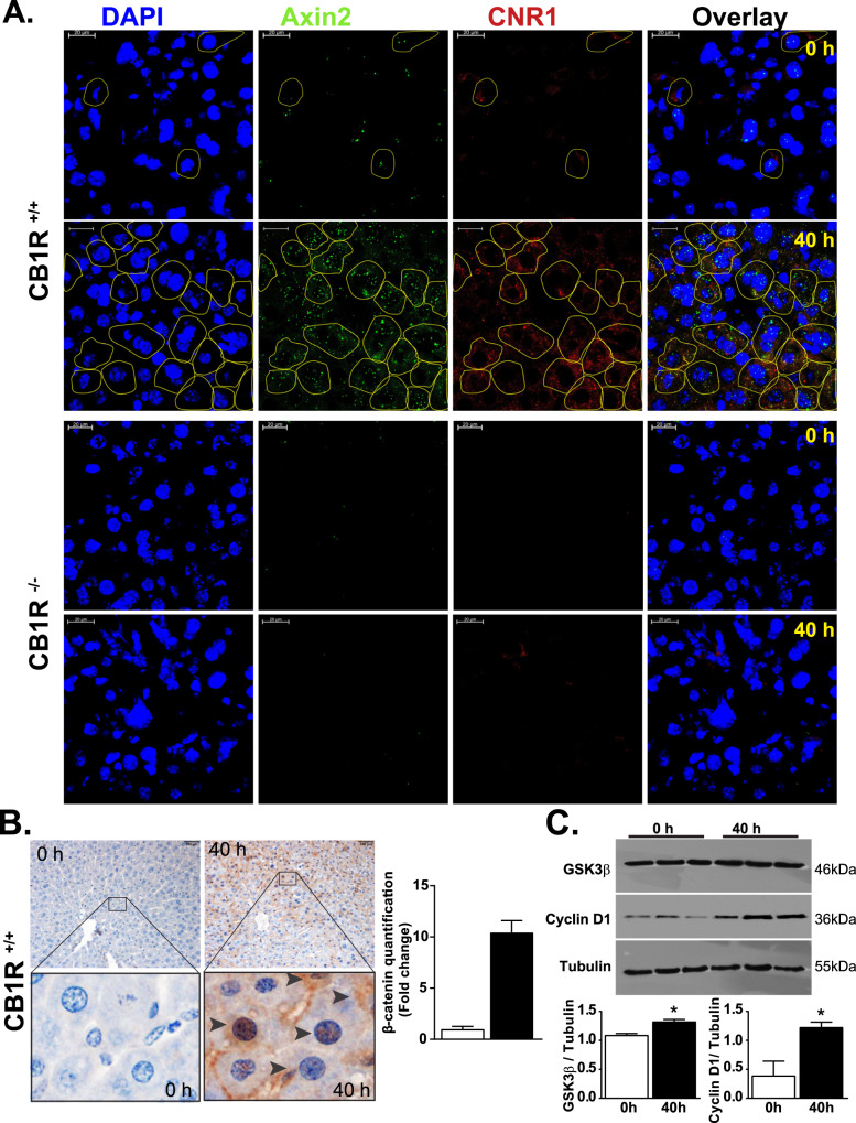 Expression of Axin2 and Cnr1 in post-hepatectomy remnant liver from wild-type (CB1R+/+) and CB1R−/− mice.A Representative RNAScope analyses of Axin2, Cnr1 and their co-expression in wild-type (CB1R+/+) and CB1R−/− liver samples at 0 and 40 h after PHx. B Representative immunohistochemical analyses and quantification of β-catenin protein expression in 0 h control and 40 h post-PHx liver from wild-type mice. C Representative western blot analyses and quantification by densitometry of the β-catenin target proteins GSK3β and Cyclin D1 in 0 h control and 40 h post-PHx liver samples.