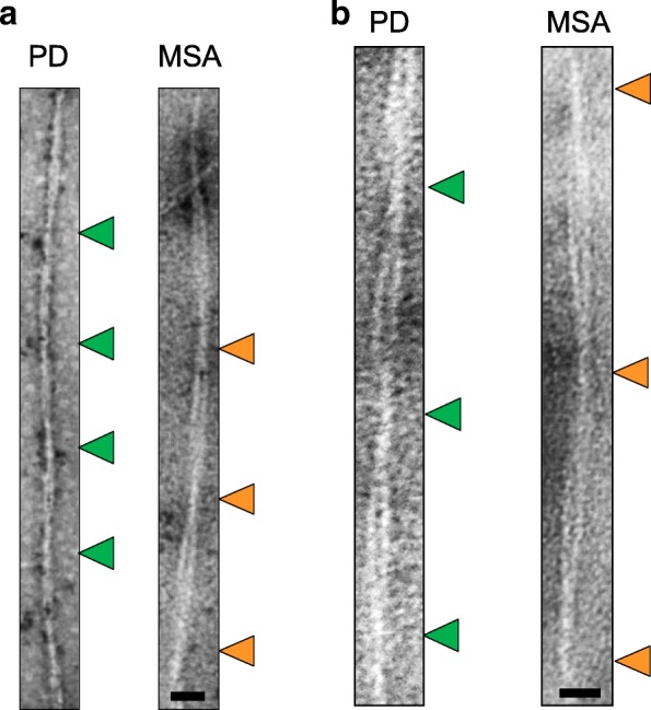Representative TEM images of RT-QuIC products seeded with OM samples derived from PD and MSA patients. a Measurements of the distance between over-twists in final RT-QuIC fibrils seeded with samples of PD (n = 5) and samples of MSA (n = 5). As shown, the distance between over-twists in α-synuclein fibrils obtained from RT-QuIC products seeded with OM of MSA patients (orange arrows) was about 142 ± 1.3 nm (mean ± standard error of the mean) while that of PD patients (green arrows) was shorter and about 131 ± 1.1 nm and such differences were statistically significant (p < 0.0001, Mann-Withney U test). Scale bar: 35 nm. b TEM images of the same samples taken at higher magnification. Scale bar: 23 nm
