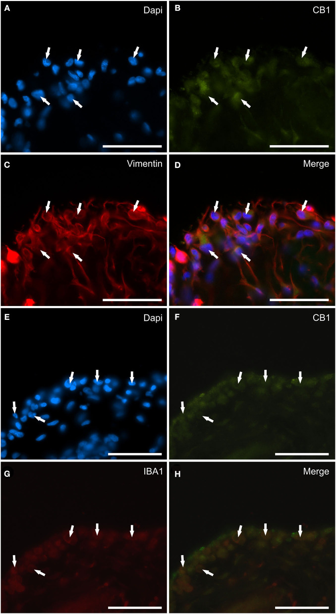 Photomicrographs of the cryosections of the synovial membrane of a horse metacarpophalangeal joint showing cannabinoid receptor type 1 (CB1) immunoreactivity in synoviocytes. (A–D) The arrows indicate the DAPI (Blue) labeled nuclei (A) of cells resembling fibroblast-like synoviocytes co-expressing faint CB1 (Green) receptor immunoreactivity (B) and bright vimentin (Red) (C) immunoreactivity. (D) Merged image (Orange). (E–H) The arrows indicate the DAPI (Blue) labeled nuclei (E) of round macrophage-like synoviocytes co-expressing faint CB1 (Green) receptor (F) and IBA1 (Red) (G) immunoreactivity. (H) Merged image (Orange). Scale bar = 50 μm.