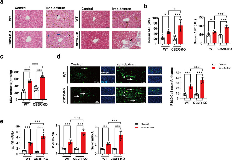 CB2R deficiency exacerbates iron overload-induced liver injury and inflammation. a Representative H&E and Masson staining of liver sections from WT and CB2R-KO mice (scale bar = 50 µm). b Serum ALT and AST activities (n = 6, 5 respectively). c Liver MDA content (n = 6). d Representative immunofluorescence staining for F4/80 (scale bar = 20 µm) and corresponding quantification of F4/80 positive cells in WT and CB2R-KO mice (n = 5). e Relative hepatic mRNA levels of IL-1β, IL-6, and TNF-α (n = 5). *P < 0.05, **P < 0.01, ***P < 0.001. Data are presented as the mean ± SD for each group. Individual data points are displayed as dots