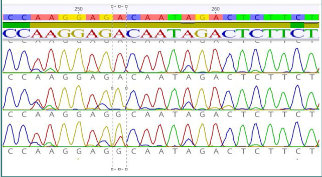 Analysis of rs1776966256 SNP of CNR1 gene
