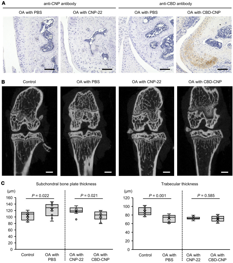 Intraarticular injection of CBD-CNP in the FVB/NJcl mouse model of knee osteoarthritis.(A) Representative DAB staining images of knee joint tissues from the mouse model of knee OA following intraarticular injection of PBS, CNP-22, or CBD-CNP. CNP-22 was detected with anti-CNP antibody, and CBD-CNP was detected with anti-CBD antibody. (B) Representative μCT images of the mouse model of knee OA with intraarticular injection of PBS, CNP-22, or CBD-CNP. The images of control and OA with PBS were obtained from the same patient. (C) Quantitative analyses of subchondral bone plate thickness and trabecular thickness using μCT images (n = 10 in control/OA with PBS, and OA with CBD-CNP groups, and n = 9 in OA with CNP-22 group). The data of control and OA with PBS were obtained from the same patients. Scale bars: 100 μm in A; 500 μm in B. Statistical analysis was performed using the Student’s t test. OA, osteoarthritis.