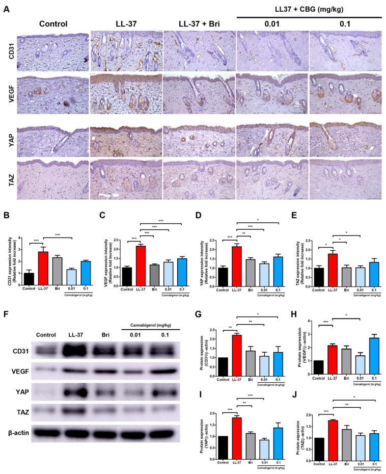Treatment with CBG reduces vascular markers and YAP/TAZ protein expression in LL-37-induced rosacea-like skin lesions. (A) Immunohistochemical (IHC) staining of CD31, VEGF, YAP, and TAZ in dorsal skin sections (original magnification, ×200; scale bar = 100 μm). (B–E) Quantification of IHC staining intensity using Fiji ImageJ software. (F) Representative Western blot images showing the protein expression levels of CD31, VEGF, YAP, and TAZ in dorsal skin lysates. (G–J) Quantitative densitometric analysis of protein bands normalized to β-actin using the ImageJ software (version 1.54f). Data are presented as mean ± SEM (n = 8). * p < 0.05, ** p < 0.01, and *** p < 0.001 compared with the control or LL-37 groups. CBG, cannabigerol; Bri, brimonidine; VEGF, vascular endothelial growth factor; YAP, yes-associated protein; TAZ, transcriptional coactivator with PDZ-binding motif; LL-37, cathelicidin peptide LL-37.