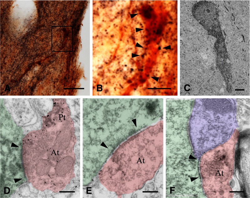 Preembedding immunocytochemical studies reveal CB1-IR synaptic afferents to GnRH neurons. Simultaneous detection of CB1-IR fibers with silver-gold grains (black color in light microscopy and electron dense metallic deposits in electron micrographs) and GnRH-IR neurons with diaminobenzidine (brown color in light microscopy and medium electron density in electron micrographs) enables the ultrastructural analysis of CB1-IR contacts on GnRH neurons. Boxed area in low-power light micrograph A is enlarged in B. Arrowheads indicate appositions of CB1-IR fibers to a GnRH-IR neuron. Low-power electron micrograph in C illustrates a GnRH-synthesizing neuron (electron dense profile) from the organum vasculosum of the lamina terminalis region. A CB1-IR axon terminal (At) (pink shading in D) establishes an asymmetric synapse (arrowheads) with a GnRH-IR dendrite (light green shading). Arrowheads point to an asymmetric axo-somatic synapse in E and a symmetric axo-somatic synapse in F. Note the accumulation of silver particles in the preterminal (Pt) segments of the CB1-IR axon (pink shading) in D–F. Blue shading in F labels a CB-negative synaptic terminal. Scale bars, 50 μm (A), 15 μm (B), 4 μm (C), and 200 nm (D–F).