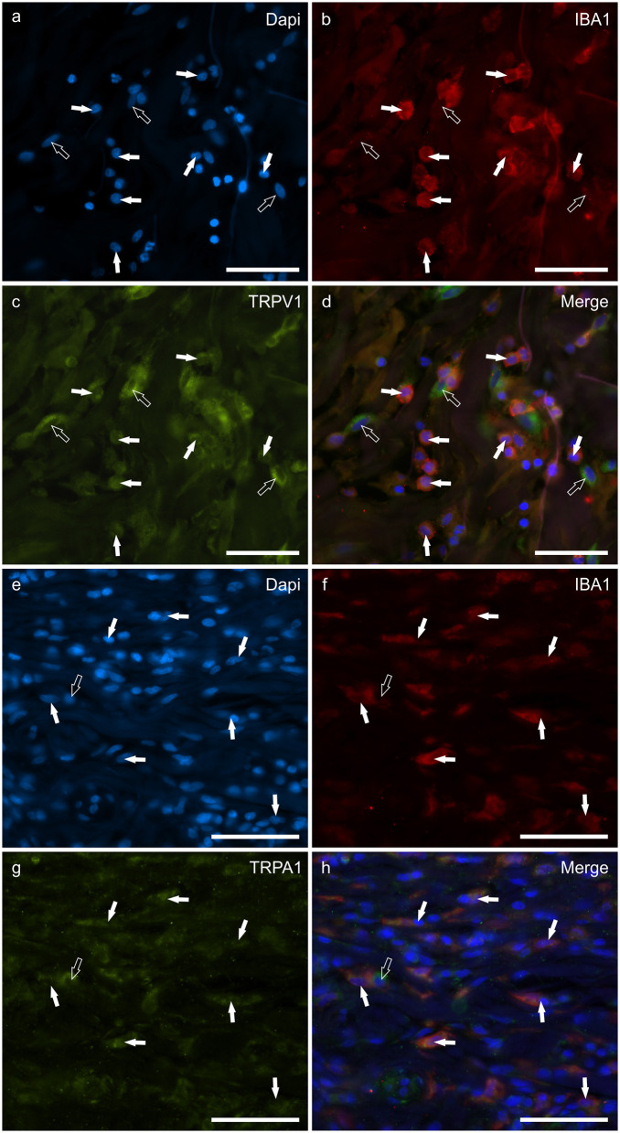 Photomicrographs of the cryosections of the skin of a dog with atopic dermatitis (AD) showing IBA1 immunoreactive cells (macrophages and dendritic cells) expressing transient receptor potential vanilloid 1 (TRPV1) (a–d) and ankyrin 1 (TRPA1) immunoreactivity (IR) (e–h). The white arrows indicate the Dapi-labeled nuclei of IBA1 positive cells co-expressing TRPV1-IR (c) and TRPA1-IR (g). The open arrow indicates one IBA1 negative cell which expressed TRPV1- (c) and TRPA1-IR (g). Bar: 50 μm.