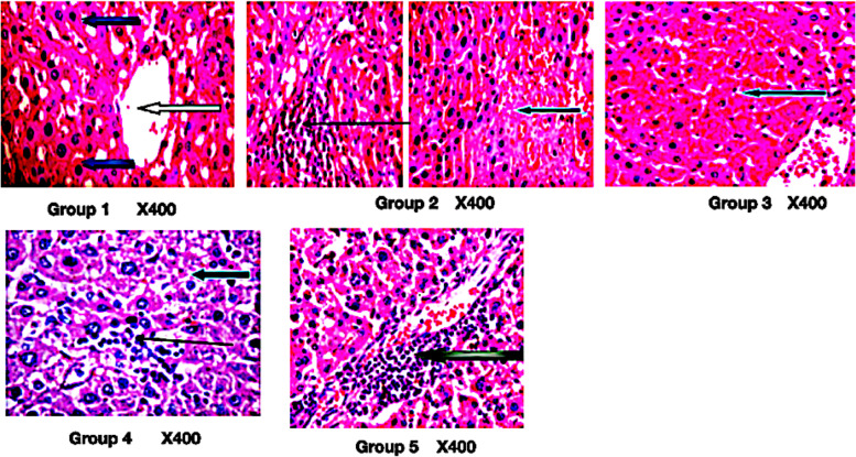 Photomicrograph of liver section stained by hematoxylin and eosin. Group 1: normal architecture as seen in lower magnification, the central venules appears mildly crowded (white arrows), the sinusoids appear normal (slender arrow) and devoid invasion of inflammatory cells, the hepatocytes revealed morphology that are normal (blue arrow). Group 2: mild vascular congestion (white arrow), there is a focal area of hepatocytes with necrosis (blue arrow) and infiltration of inflammatory cells (slender arrow). Group 3: focal area of moderate necrosis (blue arrow) and mild infiltration of inflammatory cells. Group 4: hepatocytes with fat infiltration (severe macovesicular and necrosis (blue arrow), there is mild portal triditis (white arrow), and sinusoid show mild infiltration (slender arrow). Group 5: portal infiltration of portal triads (black arrow), hepatocytes appear normal (blue arrow), and sinusoids show no infiltration (slender arrow)