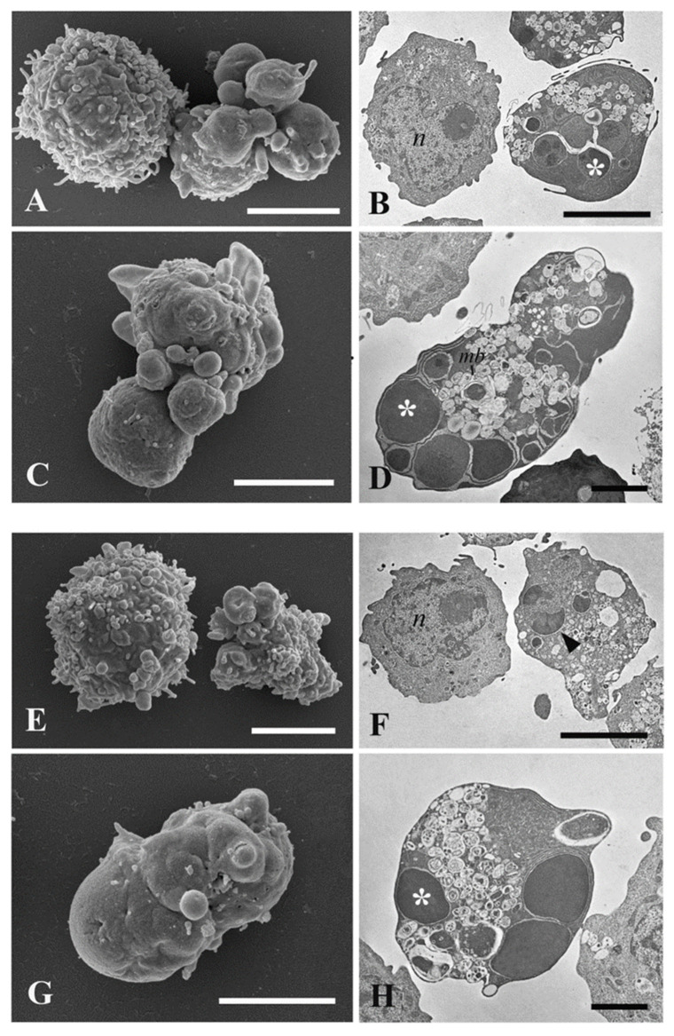 SEM and TEM investigations of ultrastructural changes induced by Kompolti hemp and Chinook hop EO treatments on HL60 cells. (A–D) Micrograph of hemp EO treated HL60 cells. (E–H) Micrograph of hop EO treated HL60 cells. n, nucleus; arrow, dead cell; mb, multilamellar bodies; asterisk, fragmented nucleus. Bars = (A–C,E–G) 5 μm; (D,H) 2 μm.