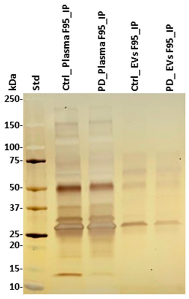 F95-enriched fractions from plasma and plasma-EVs from pre-motor PD model and sham rats. Silver stained sodium dodecyl sulfate polyacrylamide gel electrophoresis (SDS-PAGE) gel (4–20% gradient gel), showing F95-enriched protein bands from whole plasma and plasma-EVs in pre-motor PD and sham (control) rats. The protein standard is indicated on the far left in kilodaltons (kDa) (ctrl = sham; PD = pre-motor PD models).