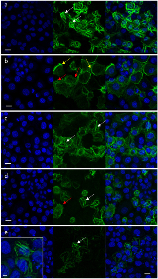Representative confocal images of OVCAR3 cells non-induced to a mesenchymal phenotype (A) and induced to mesenchymal phenotype (RPMI medium contains 5% FBS and 20 ng/mL IL-1β) (B–E) following treatment with vehicle control (1.5% v/v methanol; (B) niraparib (17.5 μg/mL; (C), F7 (10 μg/mL; (D) and niraparib + F7 (7.5 + 6 μg/mL; (E) for 16 h. Doses of treatments are based on (Shalev et al., 2022). Cells were labeled with F-ActinGreen 488 and Hoechst (blue). Bars = 20 μm; white arrows point to actin filaments; yellow arrows point to cortical actin filaments; red arrows point to mesenchymal phenotype cells. Inset in (E) shows the restored actin filament in higher resolution; bar = 5 µm. In Supplementary Figure S9 are representative images of green signal in cells generated by ImageJ (version 1.53a).