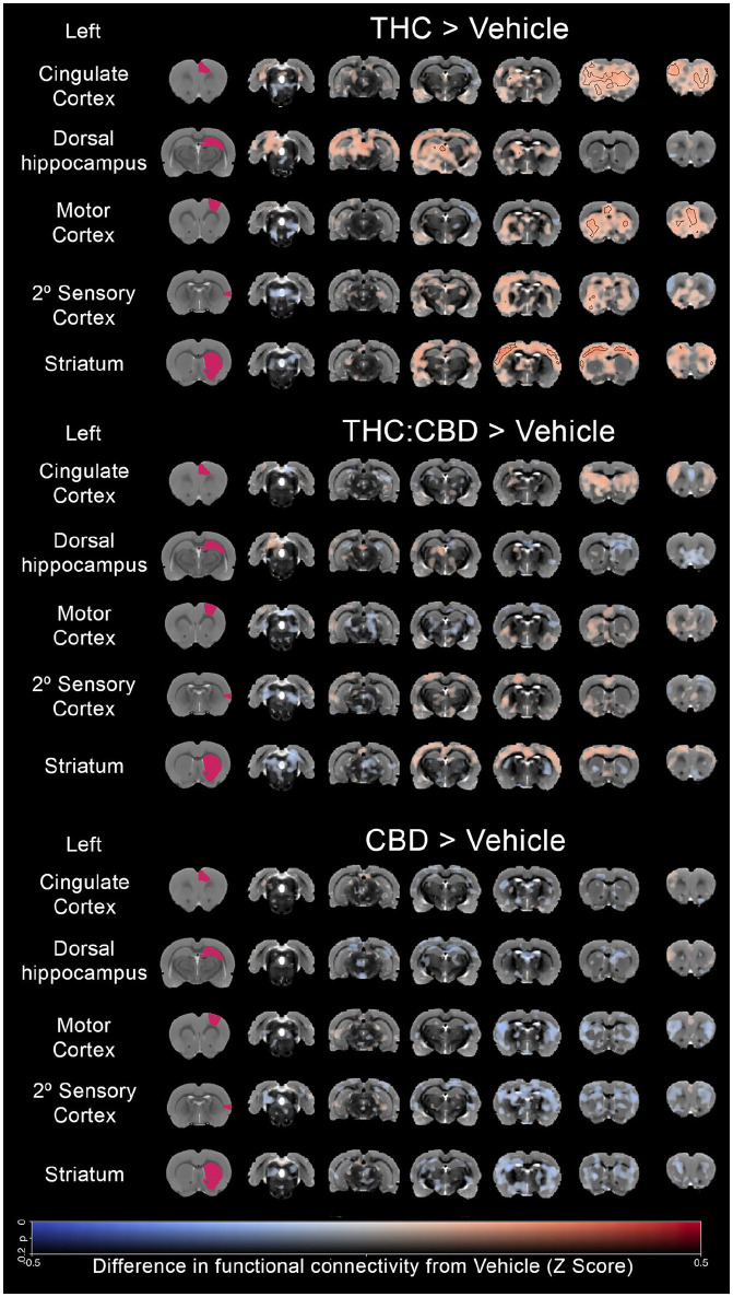 Seed analysis compares functional connectivity changes with THC, THC+CBD, and CBD, highlighting regions like cingulate, hippocampus.