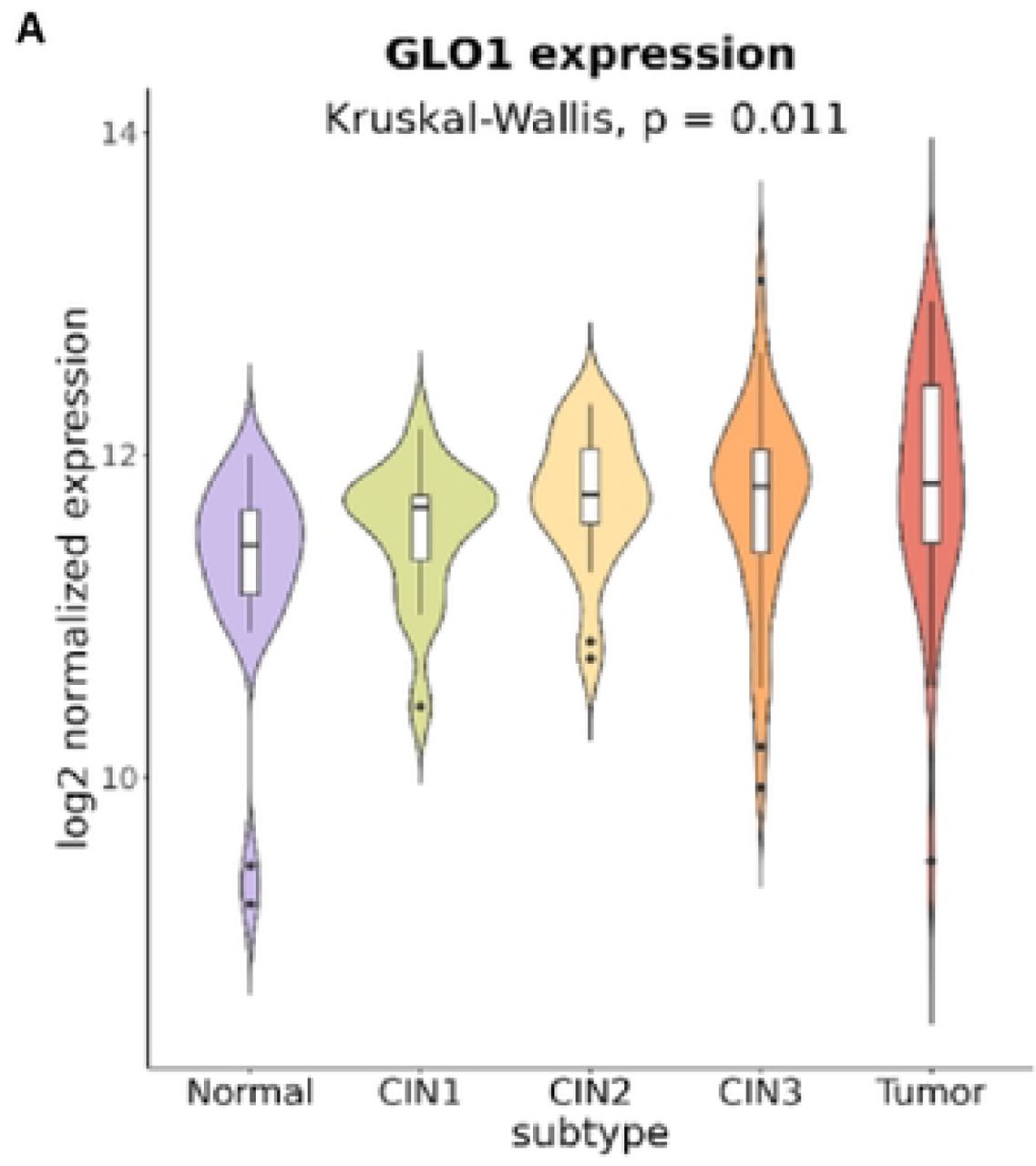 GLO1 Expression in Cervical Tissue Progression Stages.Microarray analysis of GLO1 expression in normal, cervical intraepithelial neoplasia (CIN1 to CIN3), and cervical cancer tissues. Data from GEO database (GSE63514) visualized in violin plots for 24 normal, 14 CIN1, 22 CIN2, 40 CIN3, and 28 cervical cancer samples.