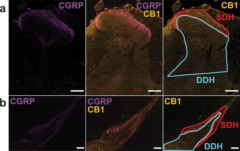 Immunoreactivity of CB1 receptors in the CGRP-positive SDH region and CGRP-negative DDH region. Representative immunopositive images from a (A) lumbar female rat and (B) thoracic male human dorsal horn showing prominent staining for CGRP in laminae I and IIo of the SDH (left, purple), overlaid with CB1 immunolabelling (middle, yellow). Right: Immunoreactivity for the CB1 receptor including the analysis outline for the SDH based on the leftmost CGRP staining (red outline) and the blue analysis outline that represents the remaining DDH region. Scale bar = 200 µm.