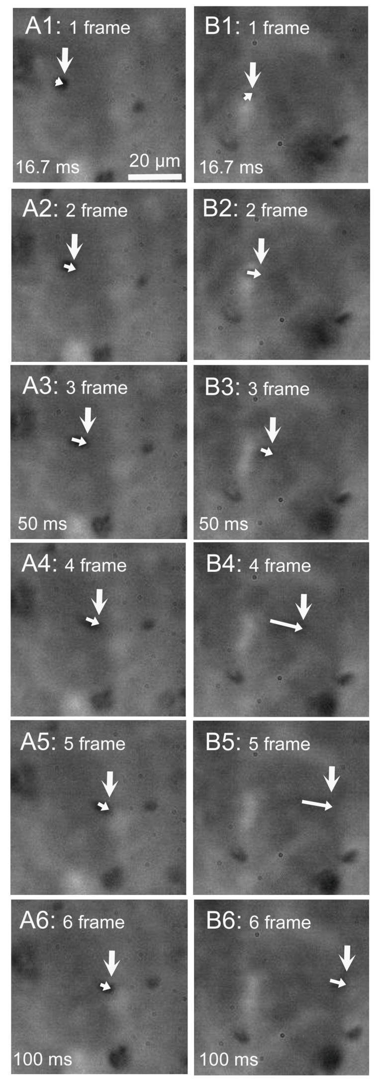 Movement of a latex microbead driven by beating cilia of a cHNECs. Experiments were carried out in the CO2/HCO3−-free solution. Movement of a microbead was recorded by a high-speed camera (60 fps). Panels A1–6 and B1–6 show six consecutive images taken every 16.7 ms. (A) Before daidzein stimulation. (B) Five min after daidzein stimulation. The initial position of the microbead is marked by a large white arrow in panels A1 and B1. Small white arrows in panels A1–6 and B1–6 show the movement of a latex microbead driven by the surface fluid flow for 16.7 ms. Stimulation with daidzein enhanced the microbead movement.